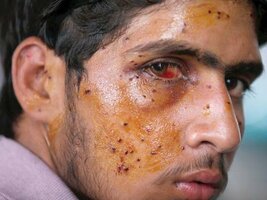 pellet guns - kashmir.jpg